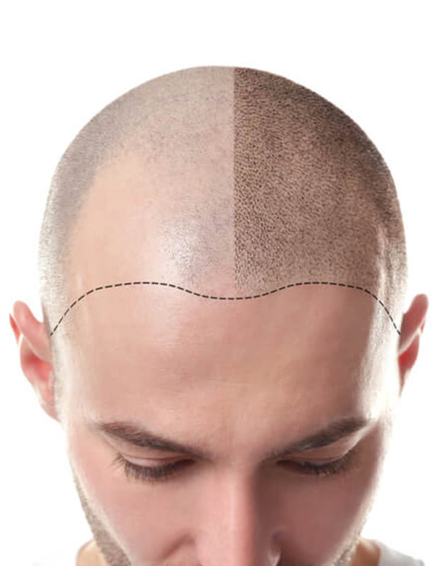 Turkish Hospital Qatar