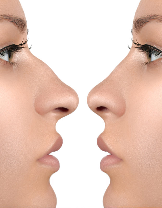 Turkish Hospital Qatar