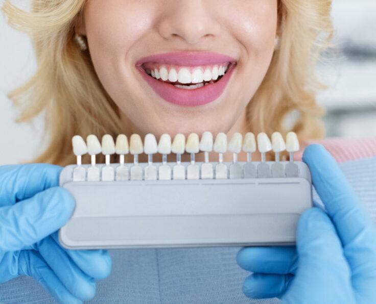 Emax Veneers By Turkish Hospital