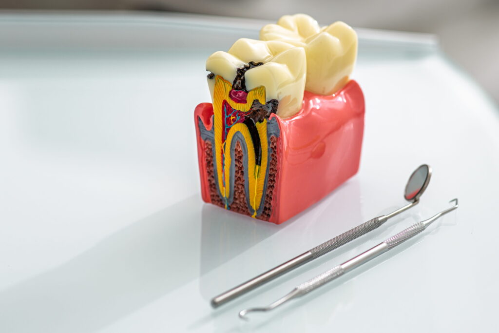 Root Canal Clinic