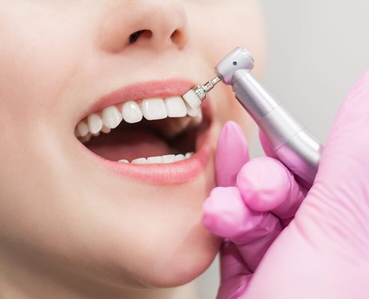 Scaling and Polishing By Turkish Hospital
