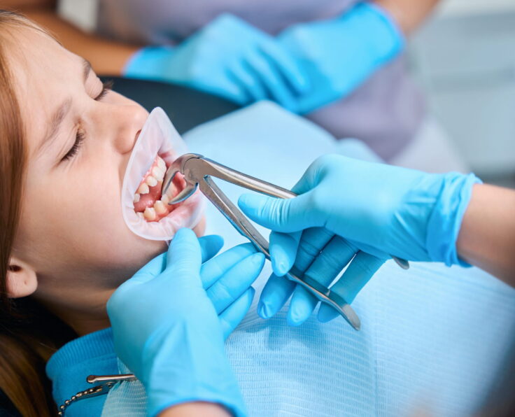 Tooth Extraction By Turkish Hospital