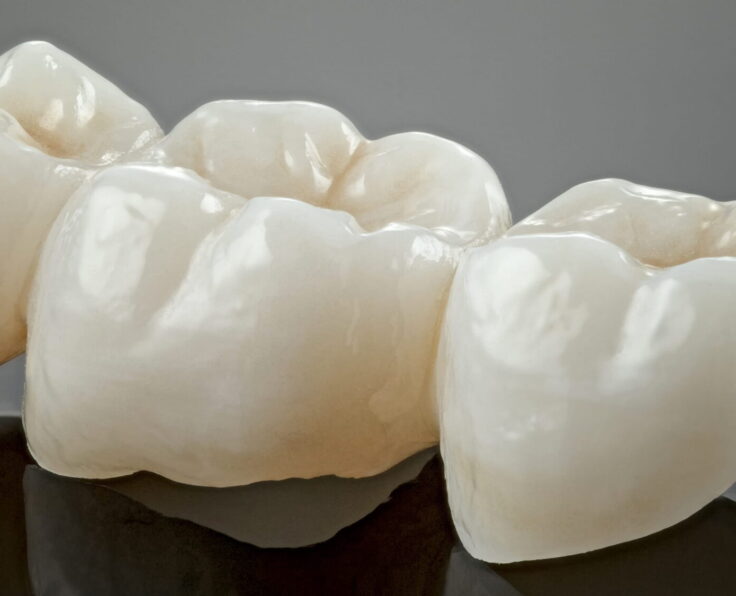 Zirconia Crowns By Turkish Hospital Qatar