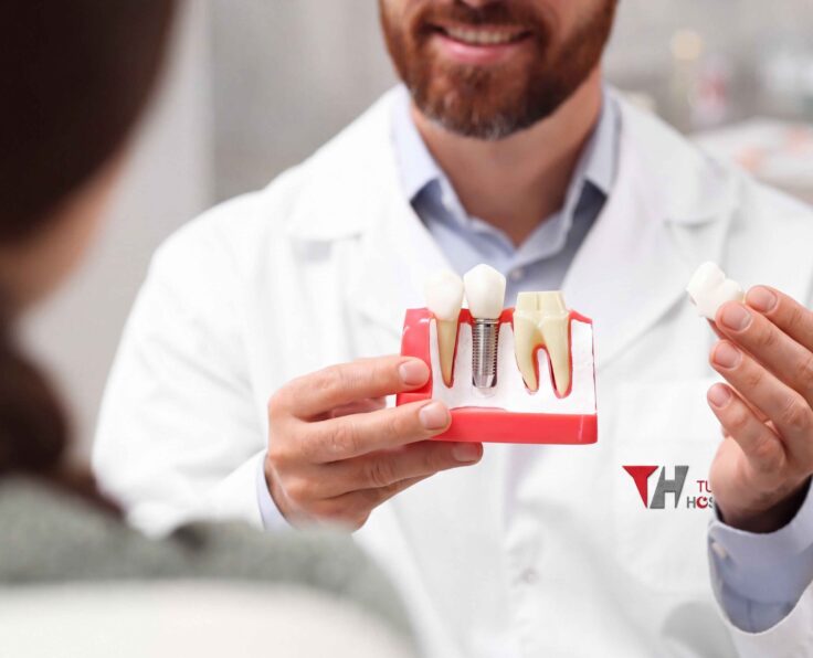 Dental Implants
