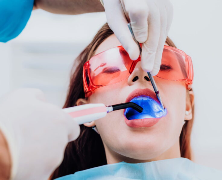 Tooth Fillings in Doha Qatar